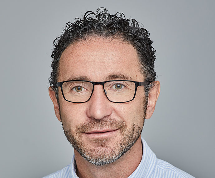 Lisztes Krisztián hajbeültetés után
