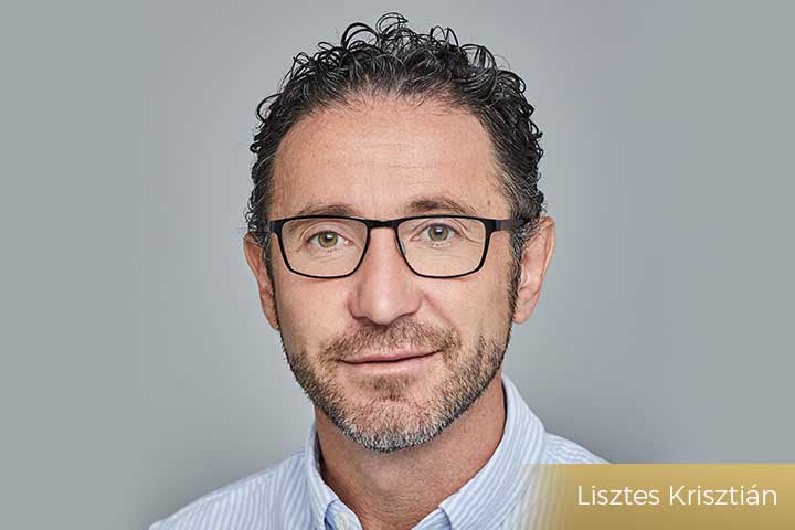 Lisztes Krisztián 10+ évvel hajbeültetése után