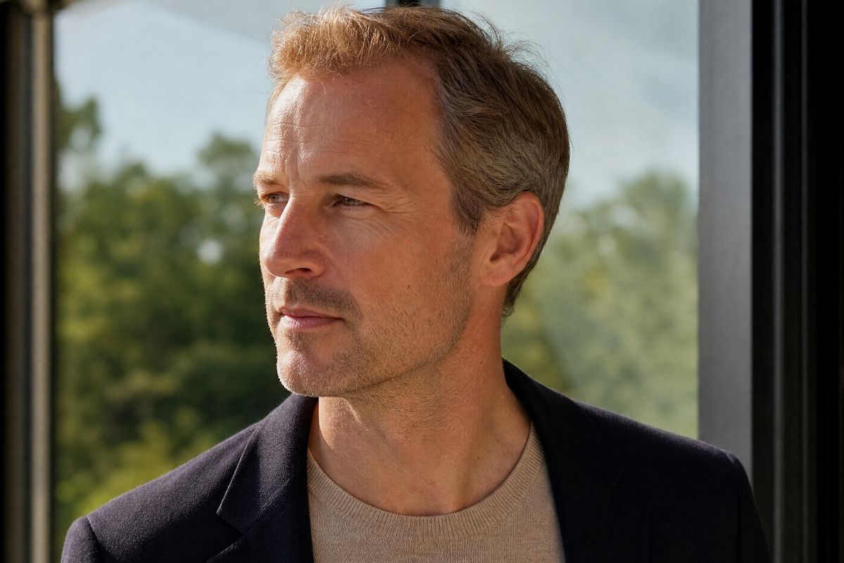 Middle-aged balding man before a spring hair transplant